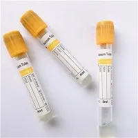 ¿Cómo elegir un tubo de vacío simple para aplicaciones de radio?